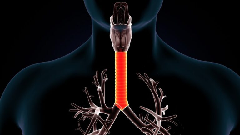 היצרות הקנה והגרון: אבחון, סימפטומים וטיפול | פרופ' יונתן להב